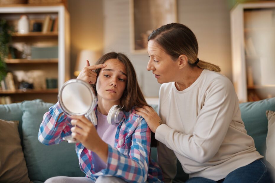 safe acne treatment for teens